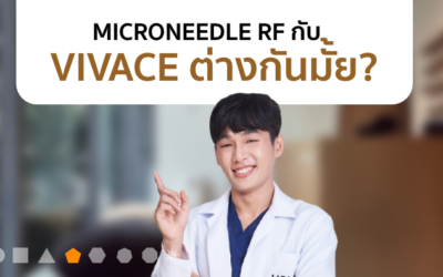 VIVACE คืออะไร?