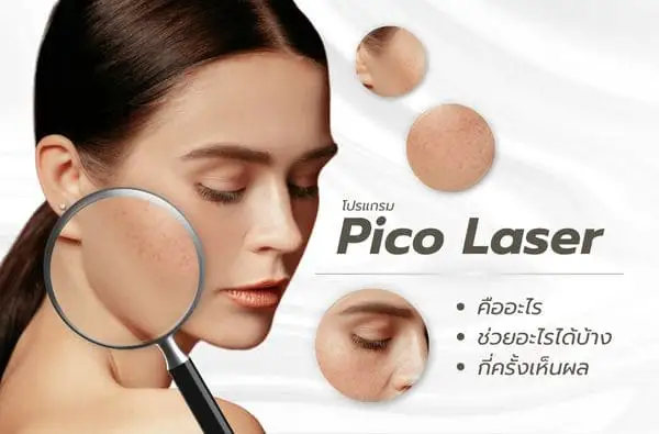 Pico Laser คืออะไร? ช่วยอะไรได้บ้าง ? กี่ครั้งเห็นผล ?